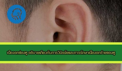 เนื้องอกช่องหู อธิบายเกี่ยวกับการวินิจฉัยและการรักษาเนื้องอกร้ายของหู